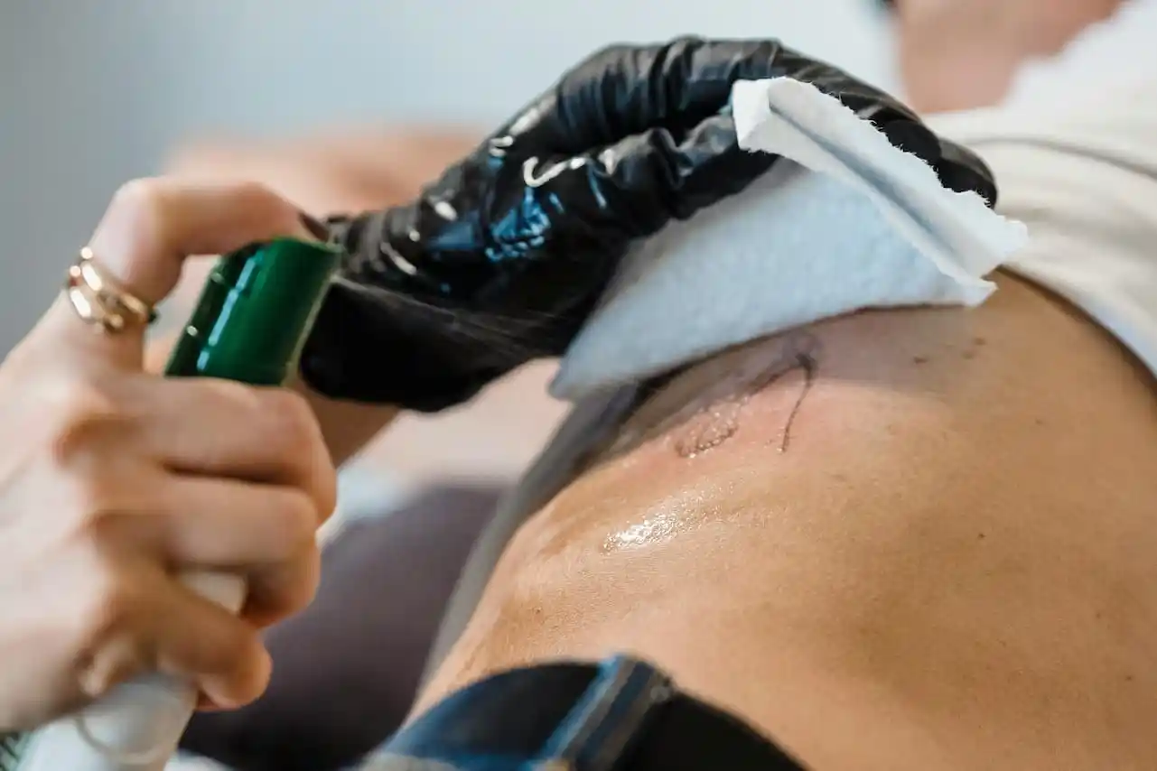 A tattoo being coated in antiseptic spray